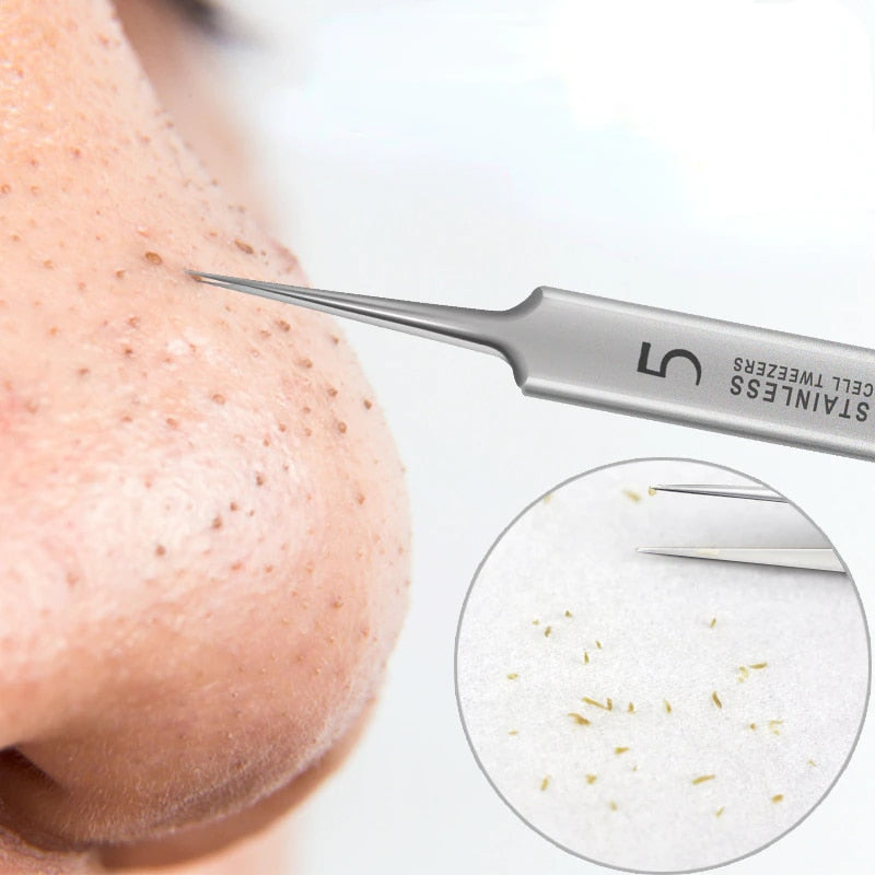 Ultra-Fine No. 5 Blackhead Remover